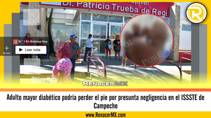 Adulto mayor diabético podría perder el pie por presunta negligencia en el ISSSTE&hellip;